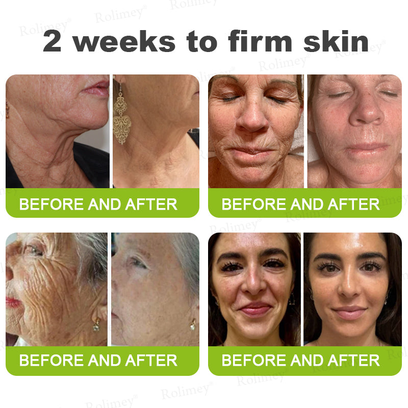 🍇Made and shipped from the USA 💫Rolimey® Botox & Vita-A Retinol Shot Wrinkle-Lift Tightening cream - Last Day Promotion 70% OFF