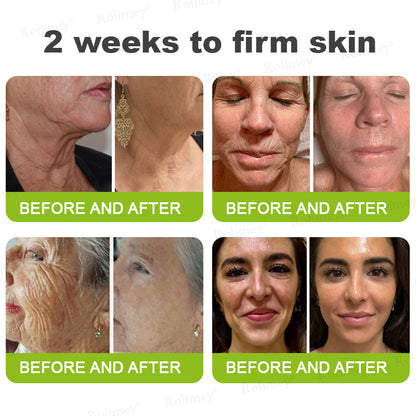 🍇Made and shipped from the USA 💫Rolimey® Botox & Vita-A Retinol Shot Wrinkle-Lift Tightening cream - Last Day Promotion 70% OFF