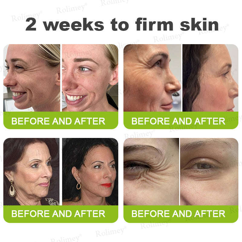 🍇Made and shipped from the USA 💫Rolimey® Botox & Vita-A Retinol Shot Wrinkle-Lift Tightening cream - Last Day Promotion 70% OFF
