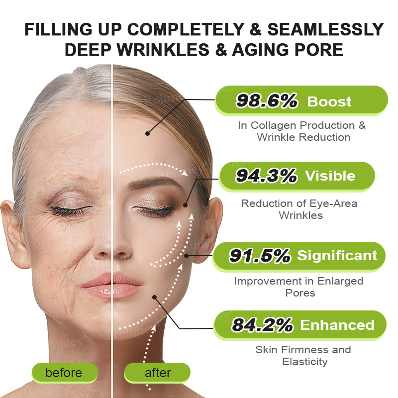 🍇Made and shipped from the USA 💫Rolimey® Botox & Vita-A Retinol Shot Wrinkle-Lift Tightening cream - Last Day Promotion 70% OFF