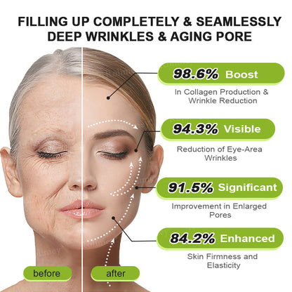 🍇Made and shipped from the USA 💫Rolimey® Botox & Vita-A Retinol Shot Wrinkle-Lift Tightening cream - Last Day Promotion 70% OFF