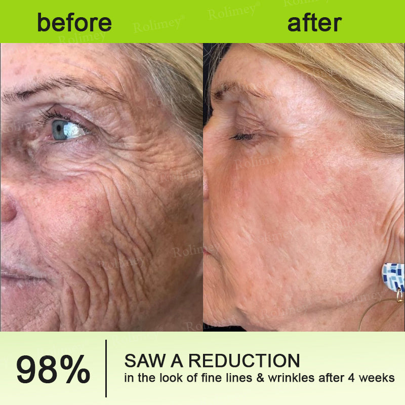 🍇Made and shipped from the USA 💫Rolimey® Botox & Vita-A Retinol Shot Wrinkle-Lift Tightening cream - Last Day Promotion 70% OFF