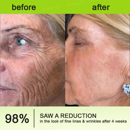 🍇Made and shipped from the USA 💫Rolimey® Botox & Vita-A Retinol Shot Wrinkle-Lift Tightening cream - Last Day Promotion 70% OFF