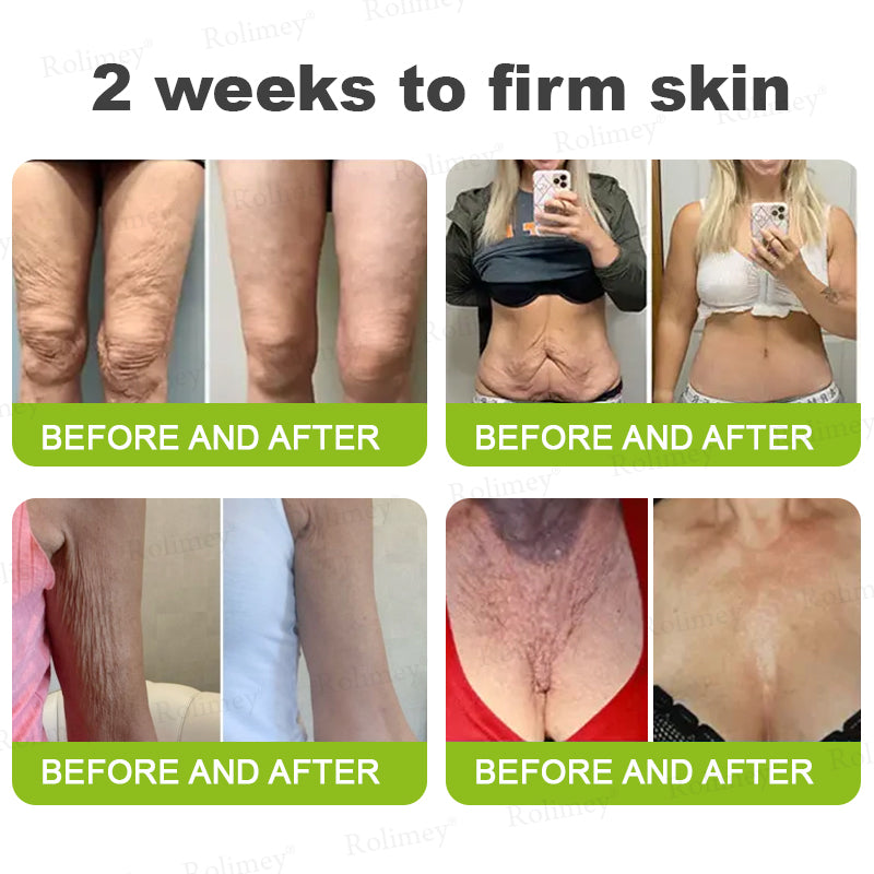🍇Made and shipped from the USA 💫Rolimey® Botox & Vita-A Retinol Shot Wrinkle-Lift Tightening cream - Last Day Promotion 70% OFF