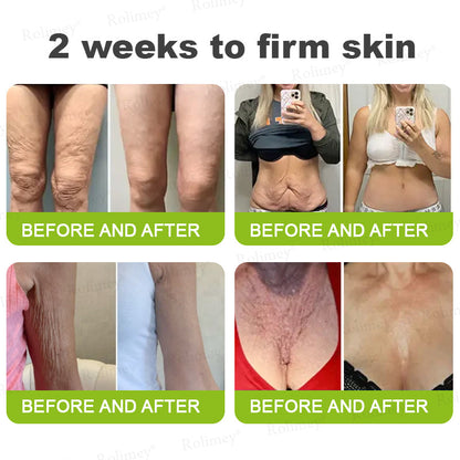 🍇Made and shipped from the USA 💫Rolimey® Botox & Vita-A Retinol Shot Wrinkle-Lift Tightening cream - Last Day Promotion 70% OFF