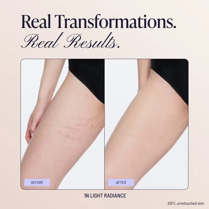 🏆 Top Rated! 80K+ SOLD! ⚡Westmore Beauty Body Coverage Perfector